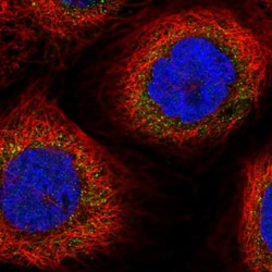 DUS2L Antibody, Novus Biologicals 25 &mu;L, Unconjugated:Antibodies, Polyclonal